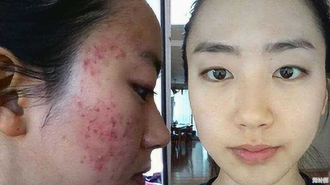 科学祛除痘印的有效方法，让你彻底告别问题肌肤困扰